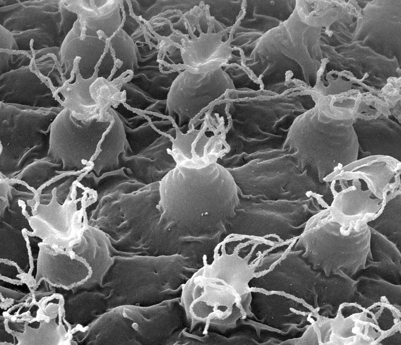 The eggs of the new tardigrade are capped with flexible filaments.